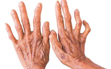 पाल्पामा छ महिनामा थपिए सात कुष्ठरोगी