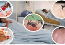 मकवानपुरमा डेङ्गी सङ्क्रमणमा वृद्धि