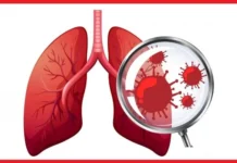 नवलपरासी पूर्वमा गण्डकी प्रदेशकै सबैभन्दा बढी क्षयरोगी