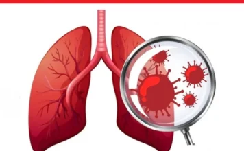 चौध वर्षमुनिका २७ जनामा क्षयरोग